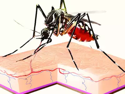"Dengue Cases in Nagpur Decline as Peak Season Comes to an End"